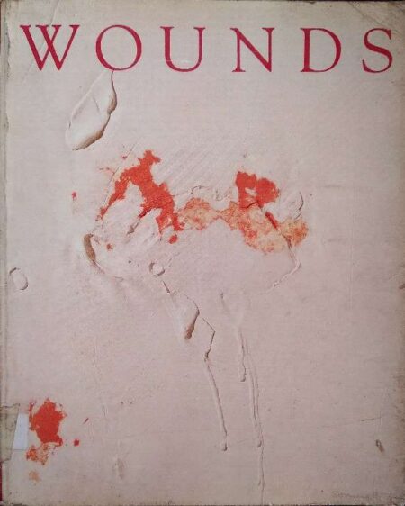 WOUNDS
