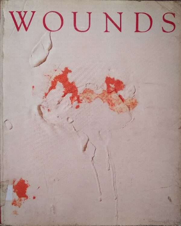 WOUNDS